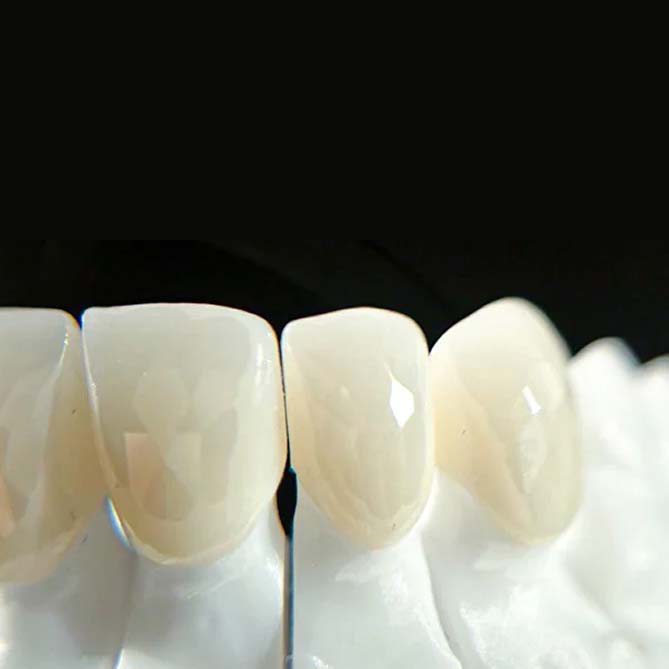 Минимальная обточка зуба