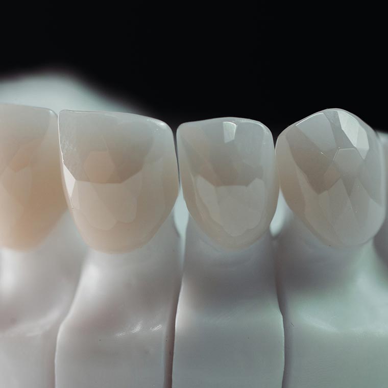 Инновационные материалы: от циркония до нанокерамики